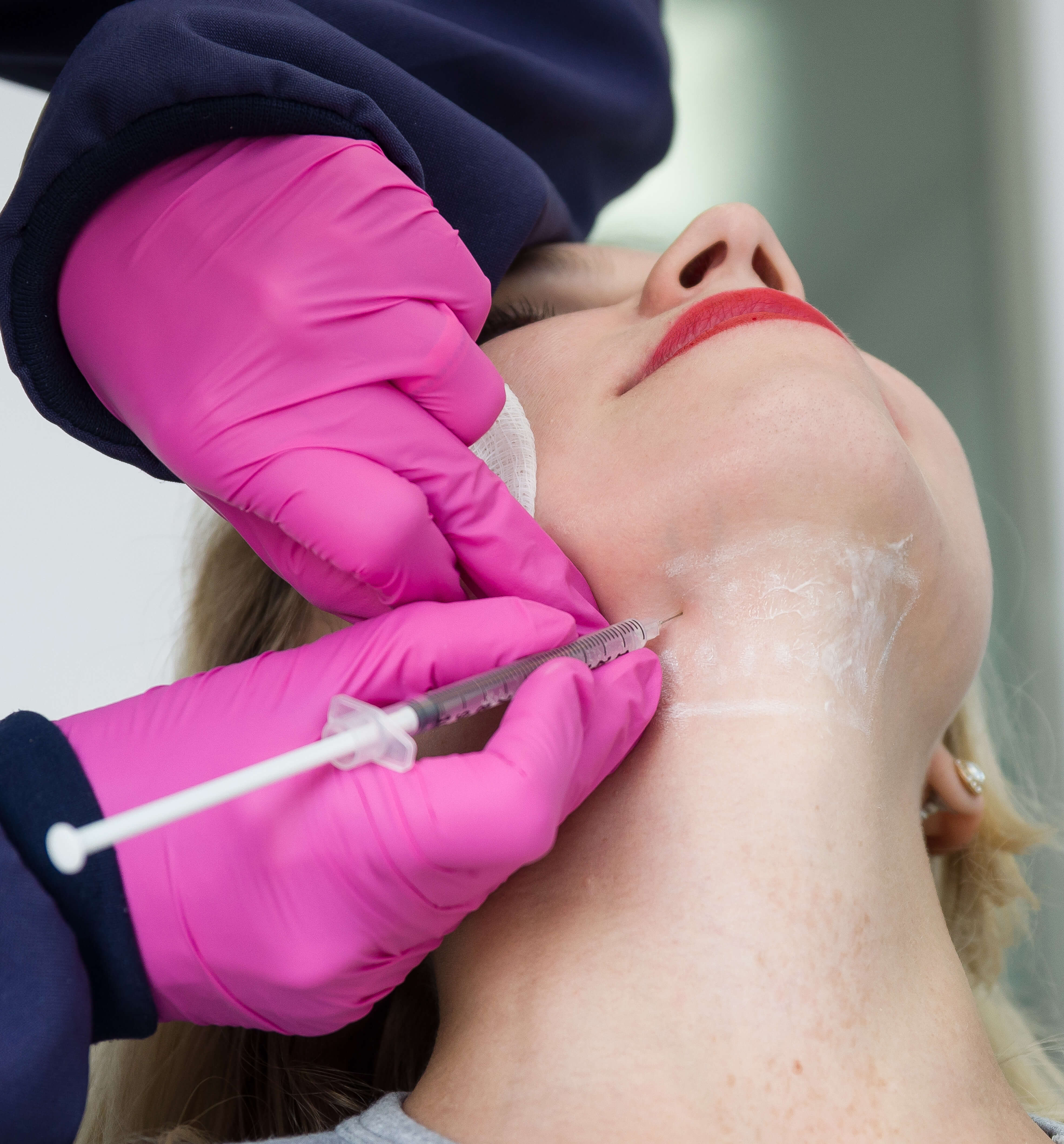Kybella